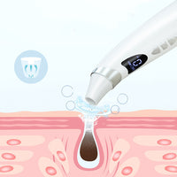 Visual pore vacuum with camera, view 4