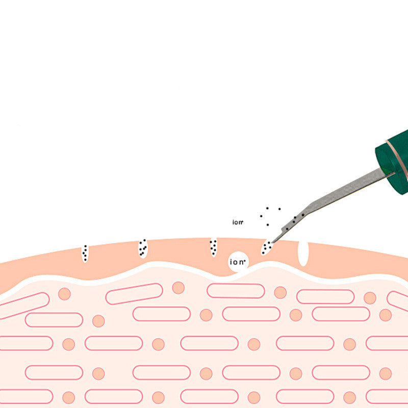 Ultrasonic skin spatula, view 7